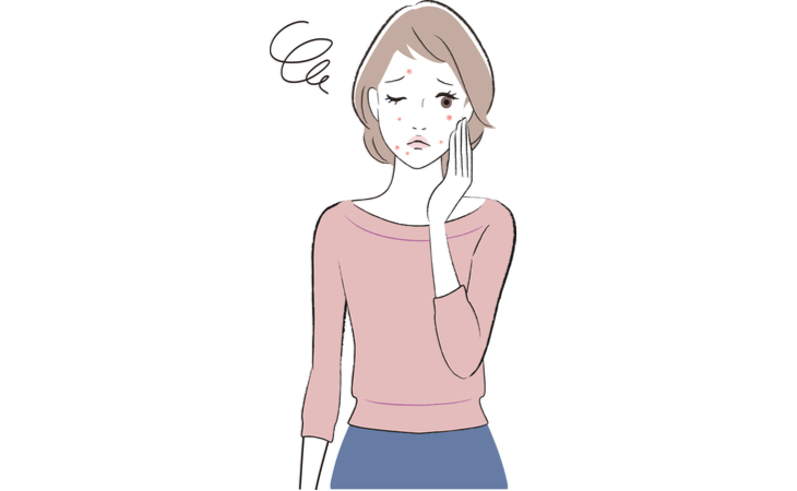 大人ニキビについて